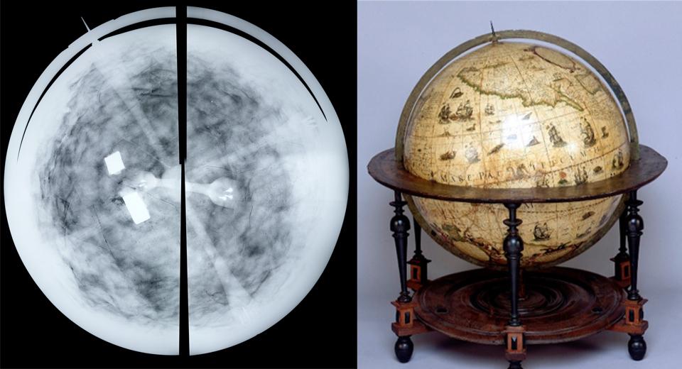 GLB0121 x-ray table globe