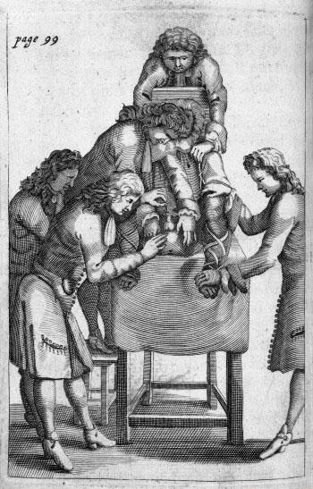 A treatise of lithotomy by François Tolet, 1683 (Wellcome Library, London)
