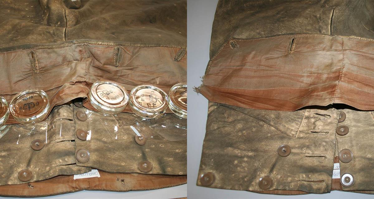 Trousers during and after treatment